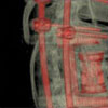 stabilizacja  kręgosłupa,  rekonstrukcja tomograficzna pooperacyjna 